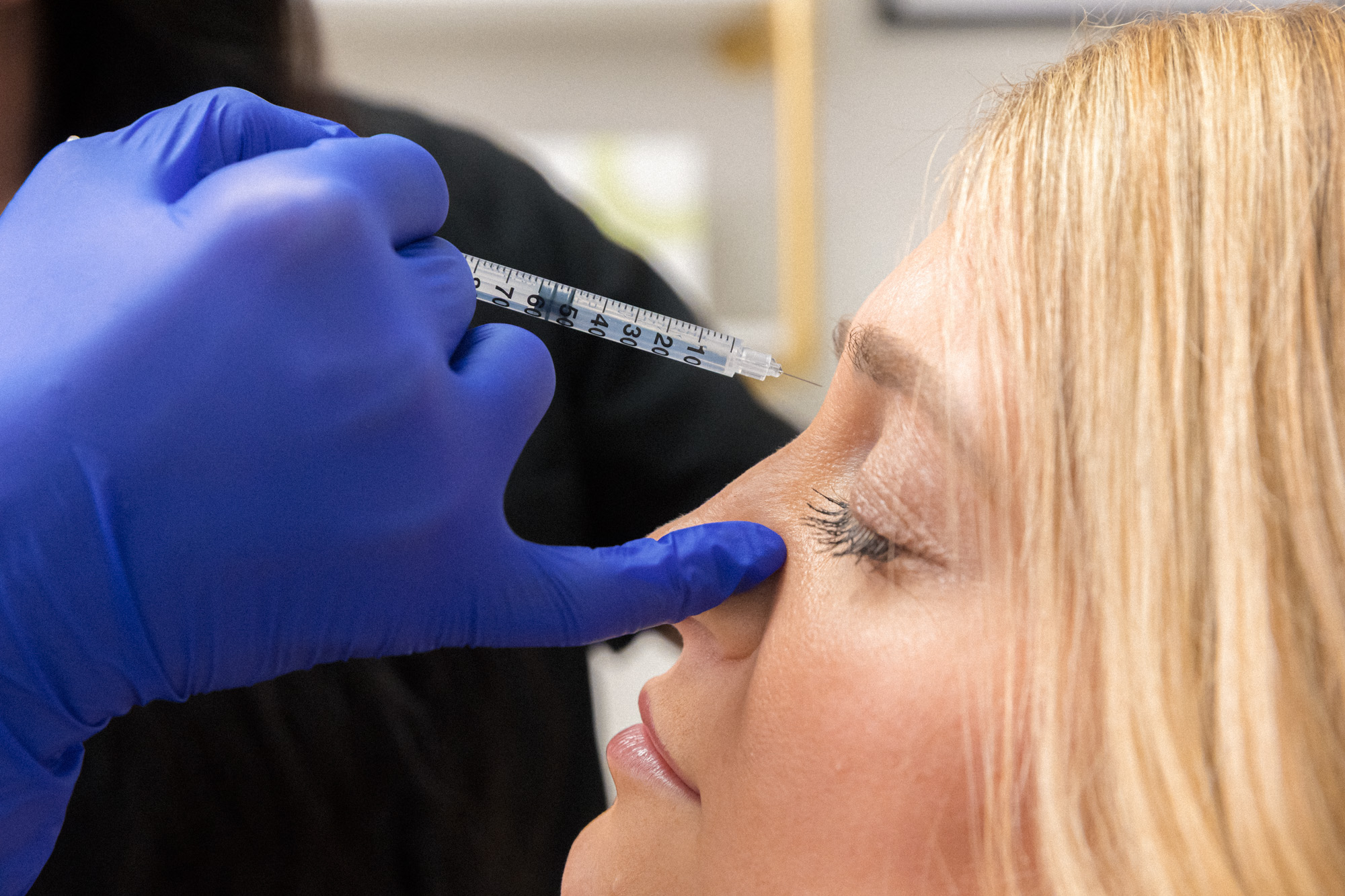 An Evolve injector precisely administers a patient's Botox in Indianapolis.