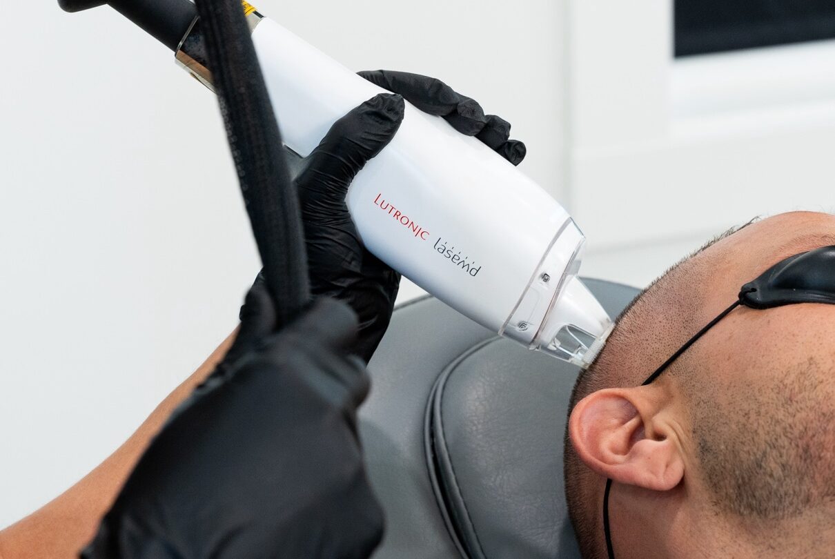 A patient undergoes hair restoration treatment alongside his HRT in Winchester, Indiana.